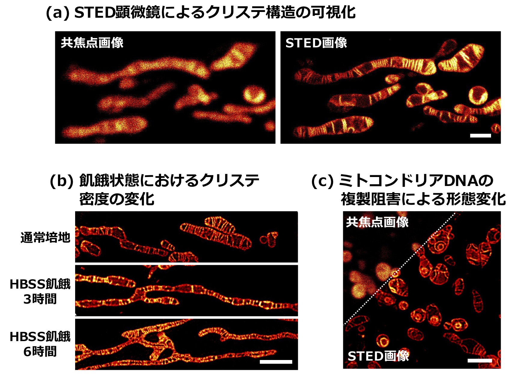 細胞が生きたままでミトコンドリアの内膜構造が鮮明に見えた 東京大学 大学院理学系研究科 理学部